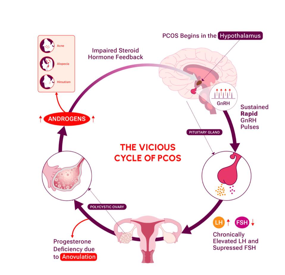 Figure 1. The vicious cycle of PCOS.