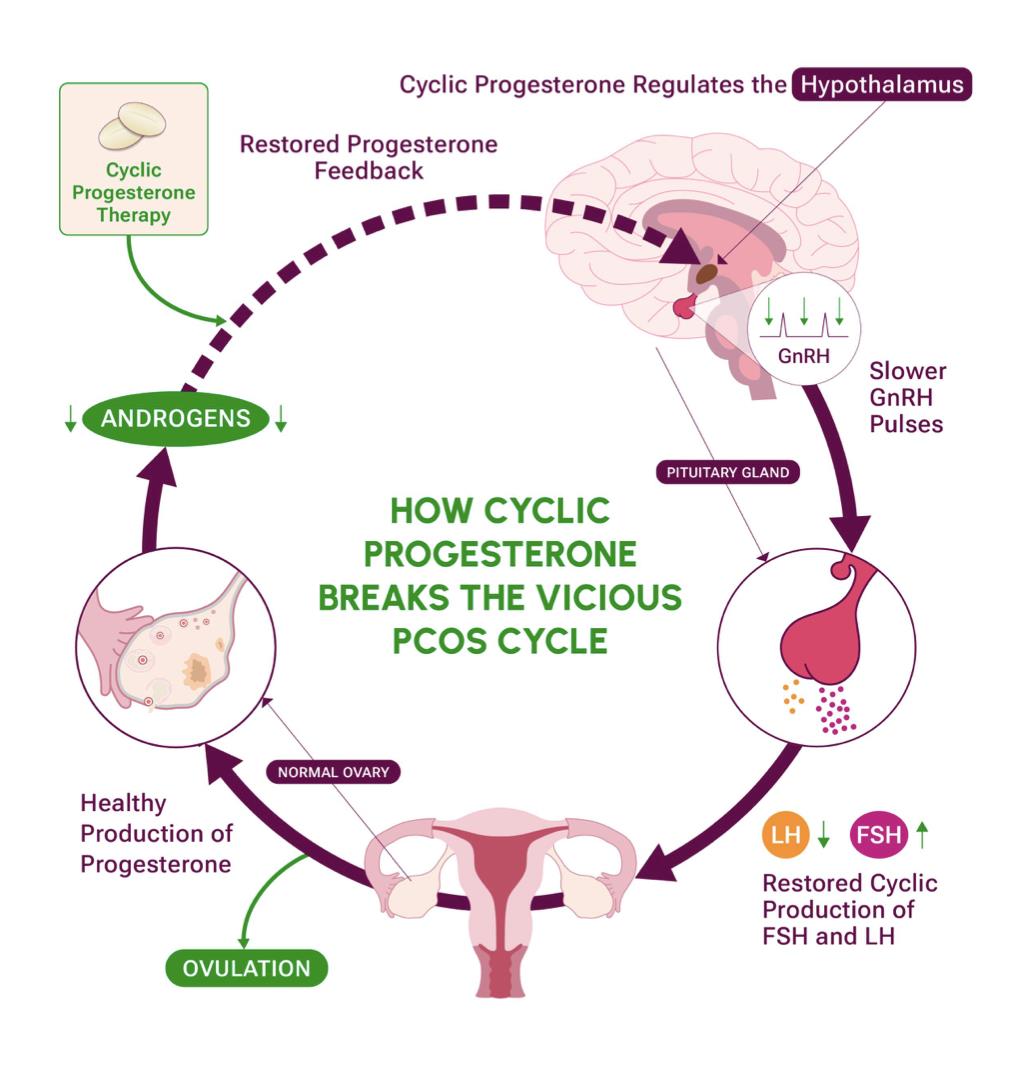 Figure 2. How cyclic progesterone breaks the vicious PCOS cycle.